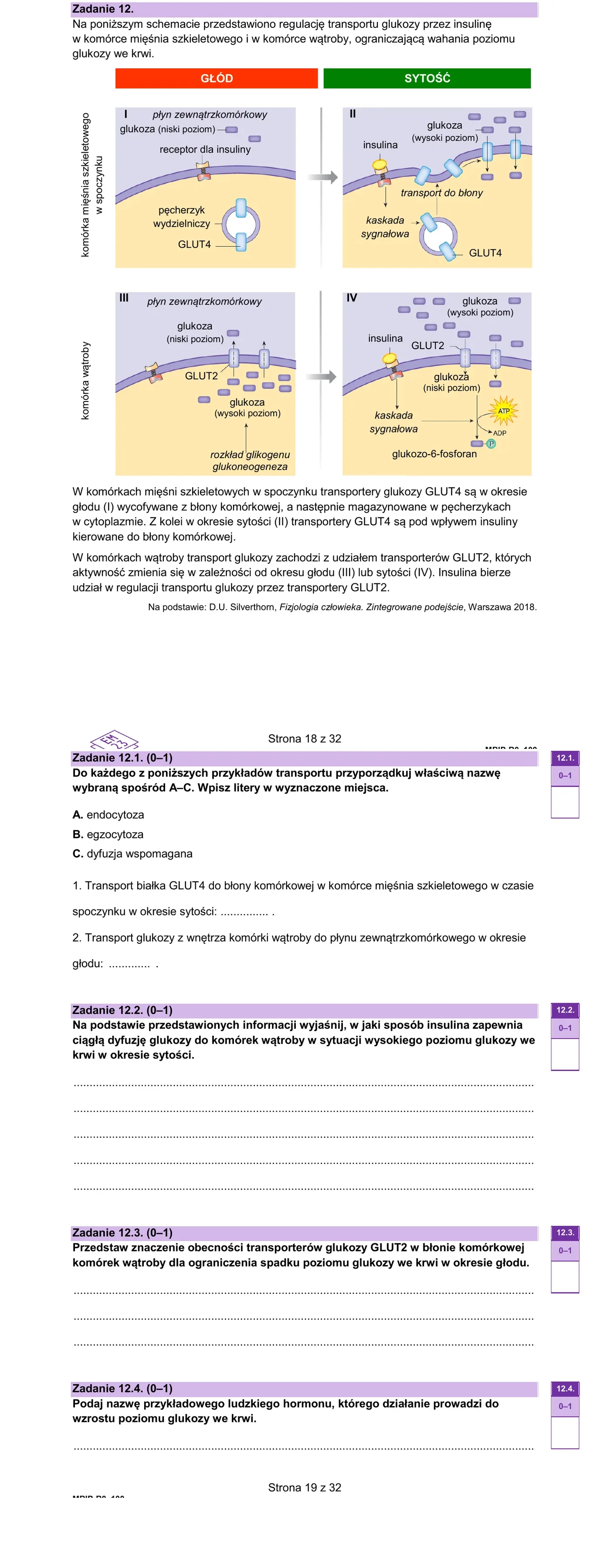 Zadanie 12 - GLUT2/GLUT4, insulina