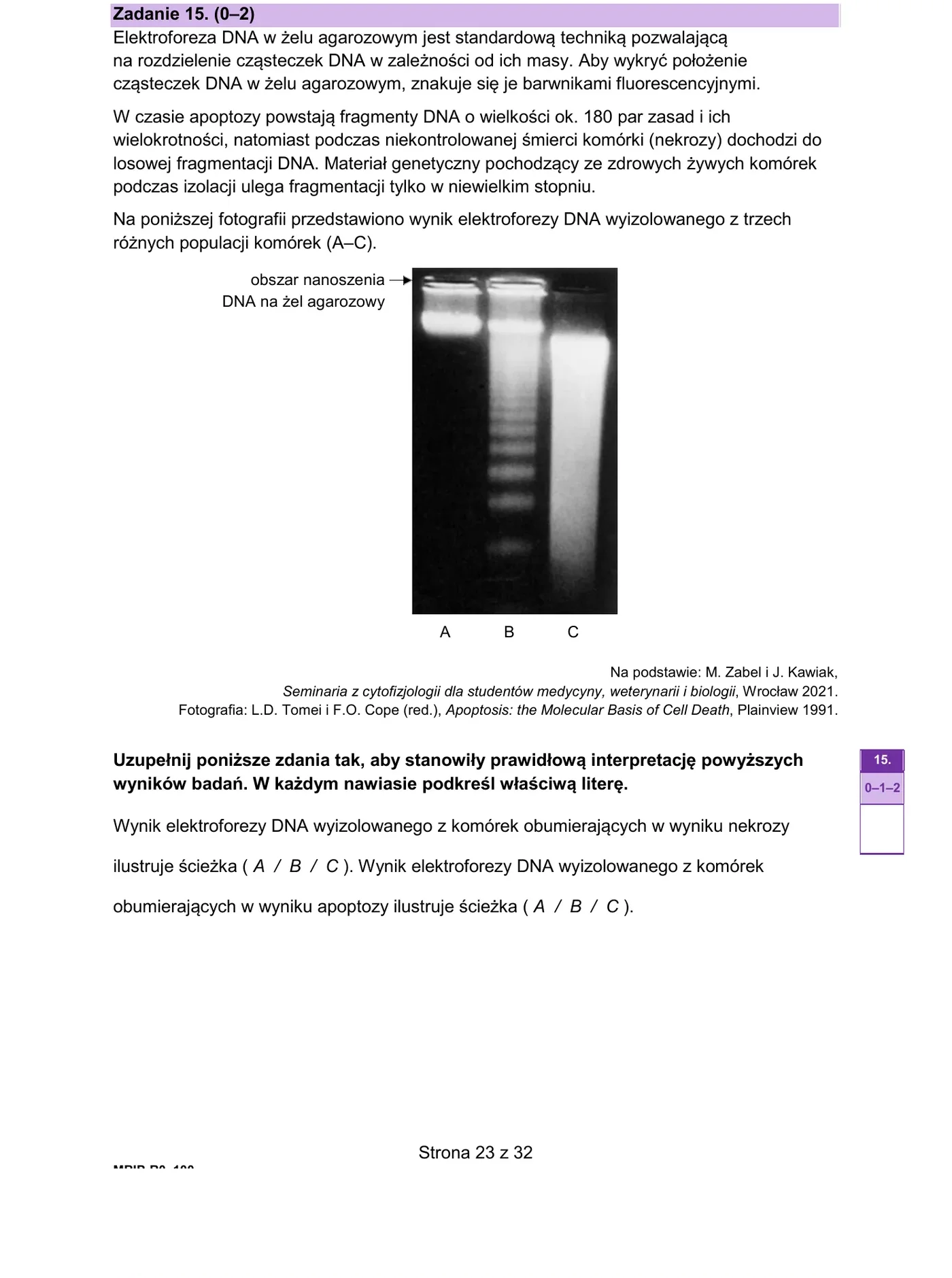 Zadanie 15 - elektroforeza DNA, apoptoza vs nekroza